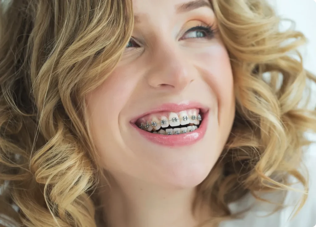 Young woman with braces smiling